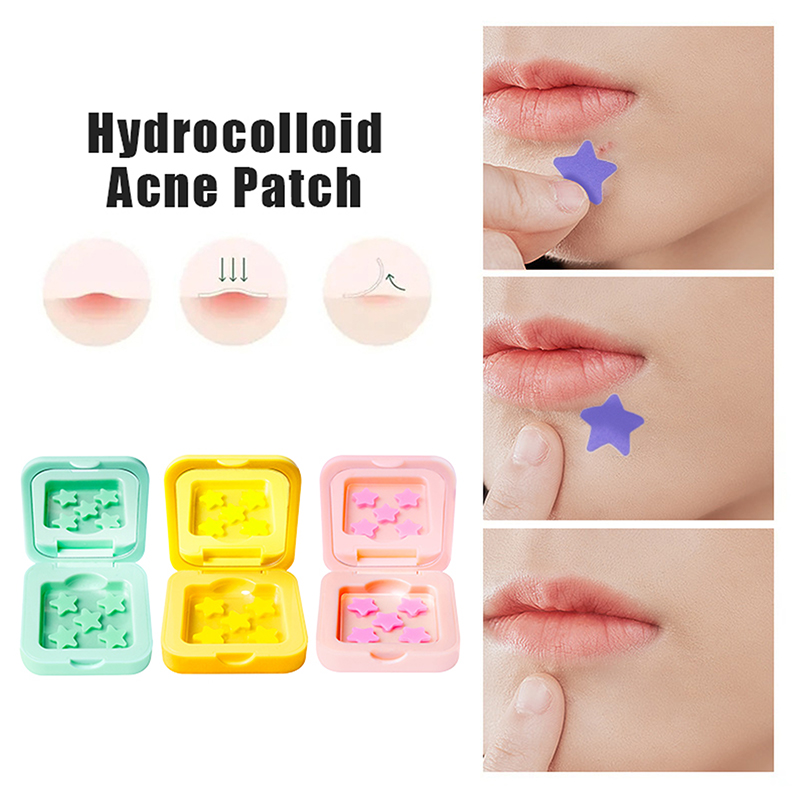 1Box Hydrocolloid Acne Patch F - огляд і ціна Glass Break Detector